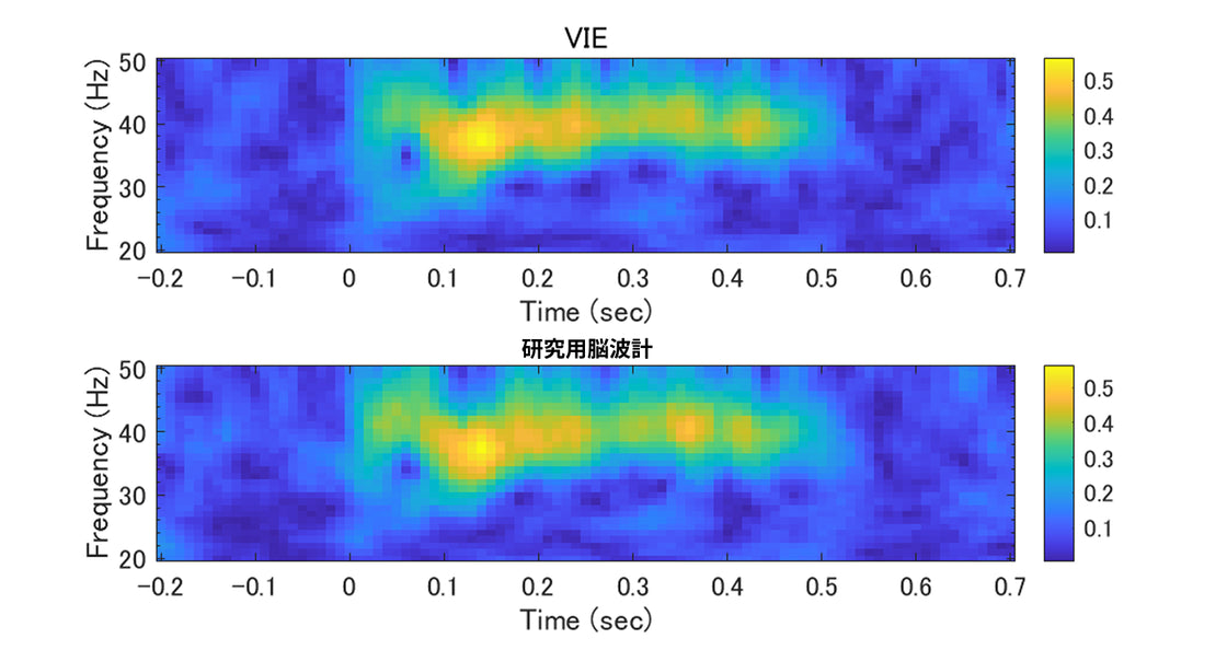 <p>ASSR課題の結果は、両デバイスの時間-周波数マップは極めて高い類似性を示している。この脳の同期応答は、刺激開始時点(Time = 0秒)からすぐには現れず、約0.1秒の遅延をもって立ち上がっており、物理的な振動を拾ったのはなく、脳活動であることを示している。</p>